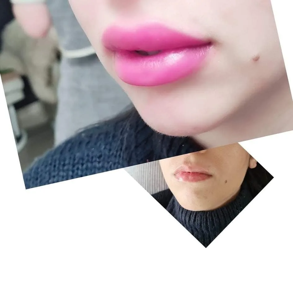 Lip tint before and after showing enhanced lip colour and shape